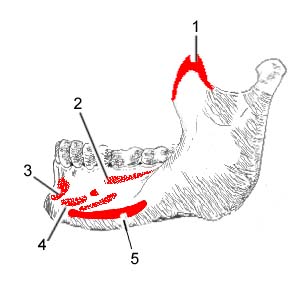 Lateral Aspect of Mandible